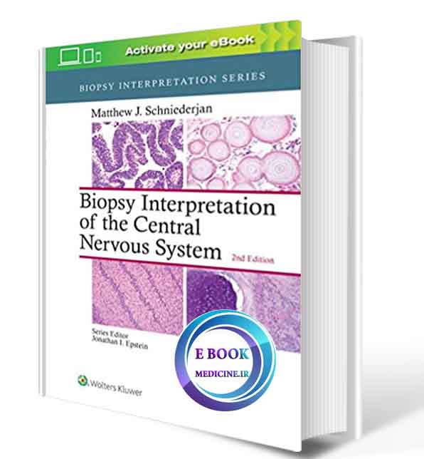دانلود کتاب Biopsy Interpretation of the Central Nervous System (Biopsy Interpretation Series) 2nd  2018 ( PDF) 